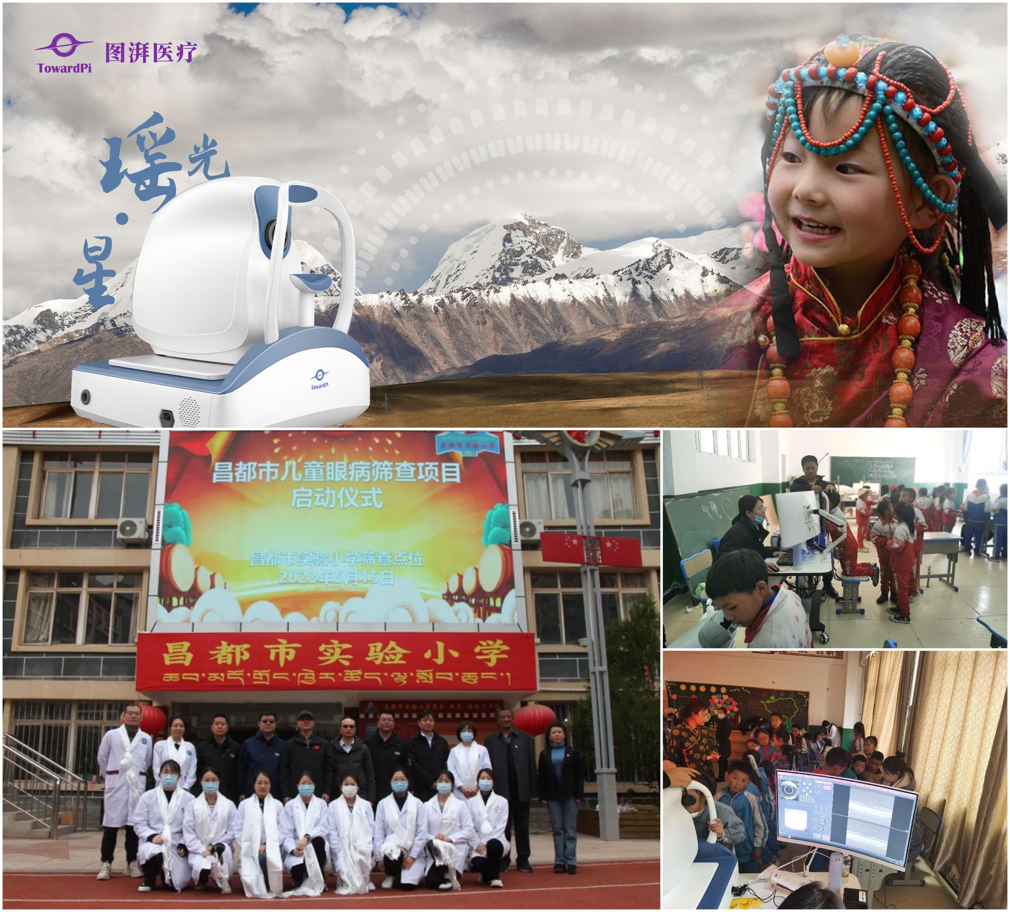 TowardPi OCT contributed to children's eye health in Tibet