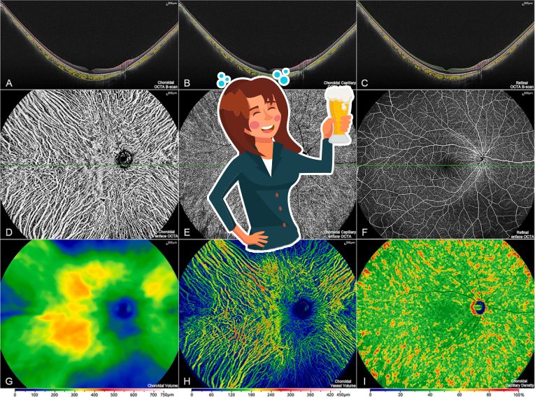 Images taken with TowardPi Bmizar 400 kHz SS-OCT show how alcohol affects ocular microvasculature